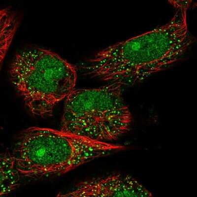 Immunocytochemistry/ Immunofluorescence: TOX4 Antibody [NBP1-88432]