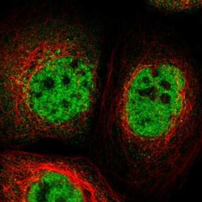Immunocytochemistry/ Immunofluorescence: TOX4 Antibody [NBP1-88433]