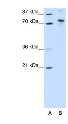 Western Blot: TOX4 Antibody [NBP1-80328]