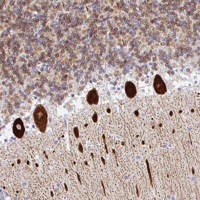 Immunohistochemistry-Paraffin: TP53I11 Antibody [NBP2-32593]