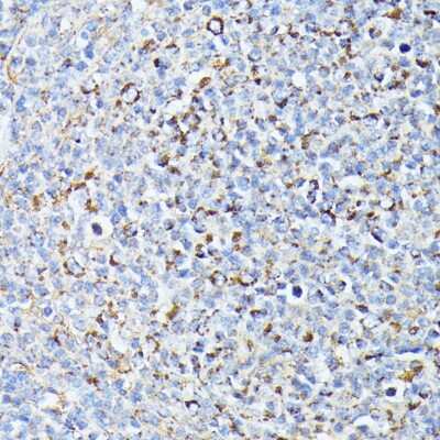 Immunohistochemistry-Paraffin: TP53I11 Antibody - Azide and BSA Free [NBP2-93452]