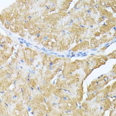 Immunohistochemistry-Paraffin: TP53I11 Antibody - Azide and BSA Free [NBP2-93452]