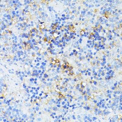 Immunohistochemistry-Paraffin: TP53I11 Antibody - Azide and BSA Free [NBP2-93452]