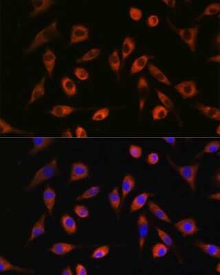 Immunocytochemistry/ Immunofluorescence: TP53I13 Antibody - Azide and BSA Free [NBP2-94004]