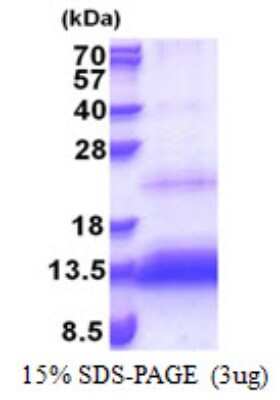 SDS-PAGE: Recombinant Human HSPC132 His Protein [NBP2-22873]