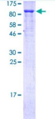 SDS-PAGE: Recombinant Human p73 GST (N-Term) Protein [H00007161-P01]