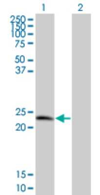 Western Blot: TPD52 Antibody (1B6) [H00007163-M01]
