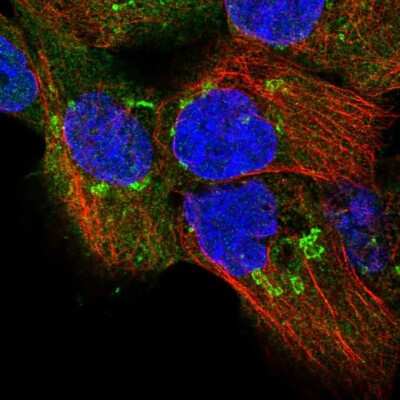 Immunocytochemistry/ Immunofluorescence: TPD52 Antibody [NBP2-38952]