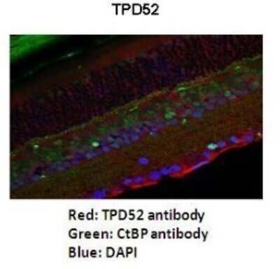 Immunohistochemistry: TPD52 Antibody [NBP1-56457]