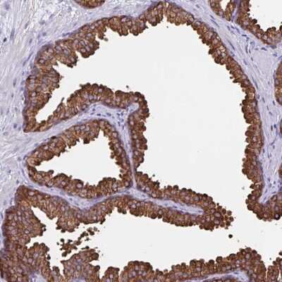 Immunohistochemistry-Paraffin: TPD52 Antibody [NBP2-38952]