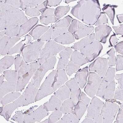 Immunohistochemistry-Paraffin: TPD52 Antibody [NBP2-38952]