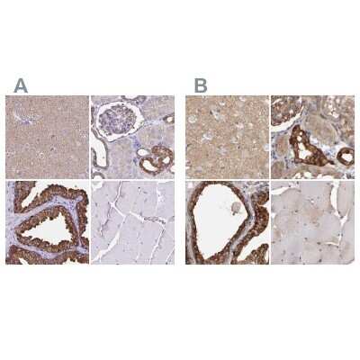 Immunohistochemistry-Paraffin: TPD52 Antibody [NBP2-38952]