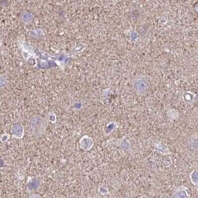 Immunohistochemistry-Paraffin: TPD52 Antibody [NBP2-38952]