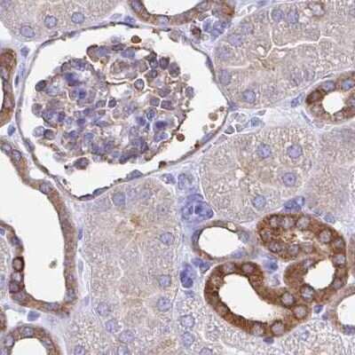 Immunohistochemistry-Paraffin: TPD52 Antibody [NBP2-38952]