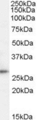 Western Blot: TPD52 Antibody [NBP1-06090]