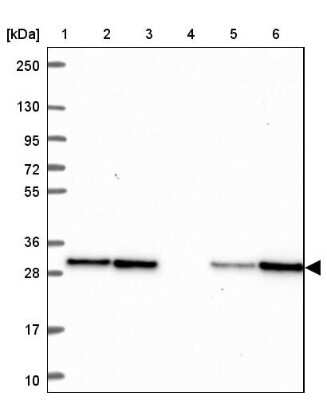 Western Blot: TPD52 Antibody [NBP2-38952]