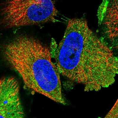 Immunocytochemistry/ Immunofluorescence: TPD52L1/D53 Antibody [NBP1-84313]