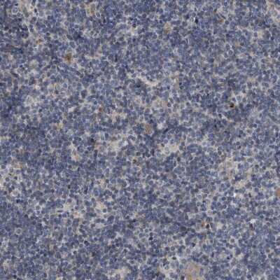 Immunohistochemistry-Paraffin: TPD52L1/D53 Antibody [NBP1-84313]