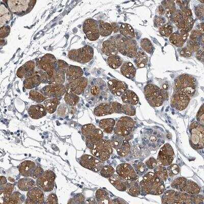 Immunohistochemistry-Paraffin: TPD52L1/D53 Antibody [NBP1-84314]