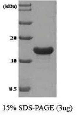 SDS-PAGE: Recombinant Human TPD52L1/D53 His Protein [NBC1-18500]