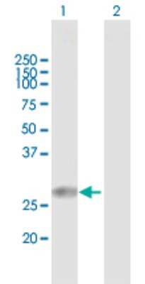 Western Blot: TPD52L2/D54 Antibody [H00007165-B01P]