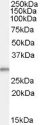 Western Blot: TPD52L2/D54 Antibody [NBP1-06092]