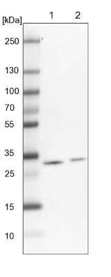 Western Blot: TPD52L2/D54 Antibody [NBP2-13468]