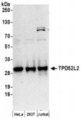Western Blot: TPD52L2/D54 Antibody [NBP2-36548]