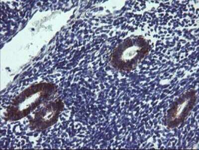 Immunohistochemistry: TPD52L3/D55 Antibody (OTI8C12) [NBP2-46012]