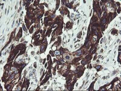 Immunohistochemistry: TPD52L3/D55 Antibody (OTI8C12) - Azide and BSA Free [NBP2-74567]