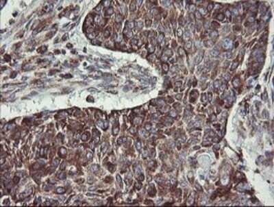 Immunohistochemistry: TPD52L3/D55 Antibody (OTI8C12) - Azide and BSA Free [NBP2-74567]