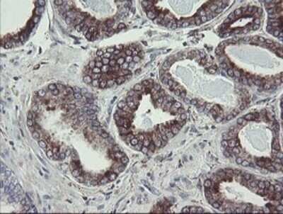 Immunohistochemistry: TPD52L3/D55 Antibody (OTI8C12) - Azide and BSA Free [NBP2-74567]