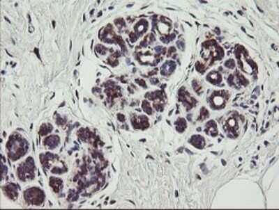 Immunohistochemistry: TPD52L3/D55 Antibody (OTI8C12) - Azide and BSA Free [NBP2-74567]