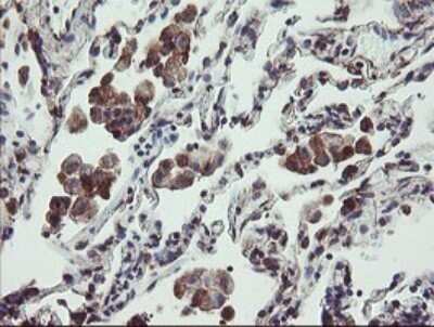 Immunohistochemistry: TPD52L3/D55 Antibody (OTI8C12) - Azide and BSA Free [NBP2-74567]