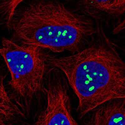 Immunocytochemistry/ Immunofluorescence: TPGS2 Antibody [NBP2-57557]