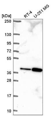 Western Blot: TPGS2 Antibody [NBP2-57557]