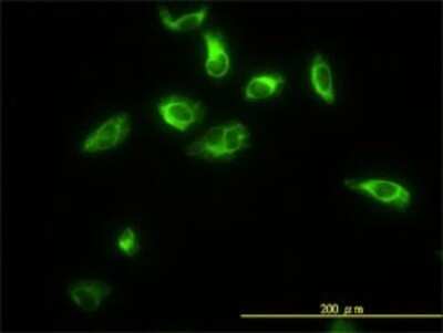 Immunocytochemistry/ Immunofluorescence: TPMT Antibody (1B5) [H00007172-M01]