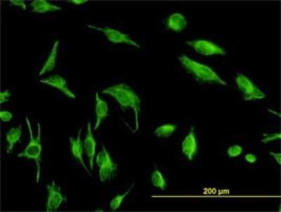 Immunocytochemistry/ Immunofluorescence: TPMT Antibody (1D4) [H00007172-M02]