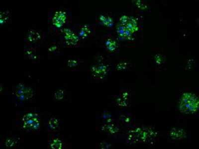 Immunocytochemistry/ Immunofluorescence: TPMT Antibody (OTI2A2) [NBP2-02356]