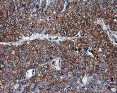 Immunohistochemistry-Paraffin: TPMT Antibody (OTI2A2) [NBP2-02356]