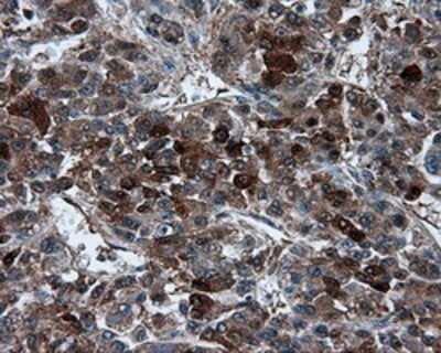 Immunohistochemistry-Paraffin: TPMT Antibody (OTI2A2) [NBP2-02356]