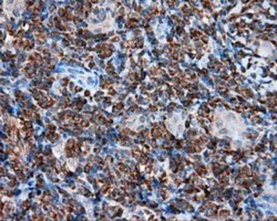 Immunohistochemistry-Paraffin: TPMT Antibody (OTI2A2) [NBP2-02356]