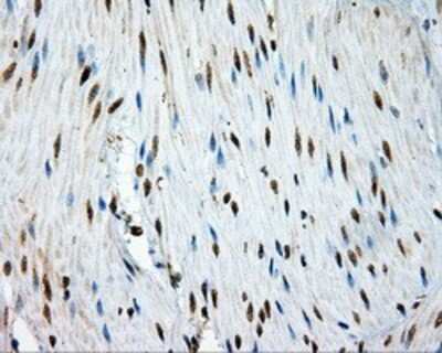 Immunohistochemistry-Paraffin: TPMT Antibody (OTI2A2) [NBP2-02356]