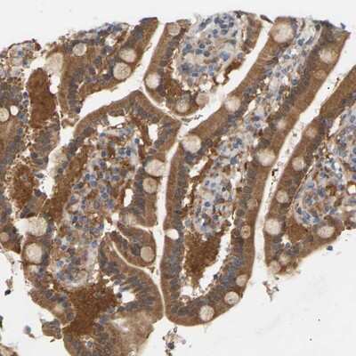 Immunohistochemistry-Paraffin: TPMT Antibody [NBP1-86032]