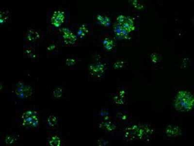 Immunocytochemistry/ Immunofluorescence: TPMT Antibody (OTI2A2) - Azide and BSA Free [NBP2-74570]