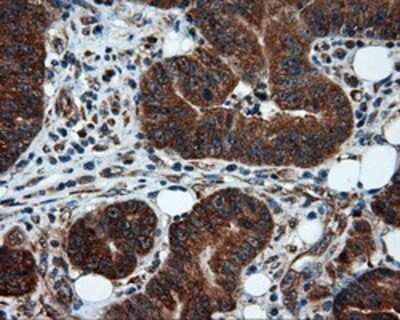 Immunohistochemistry: TPMT Antibody (OTI2A2) - Azide and BSA Free [NBP2-74570]