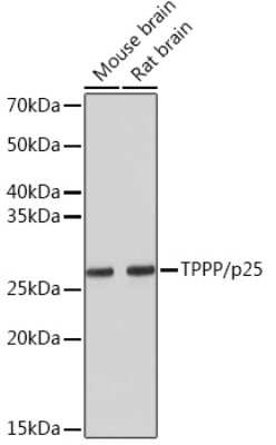 Western Blot: TPPP/p25 Antibody (3S5U9) [NBP3-16454]