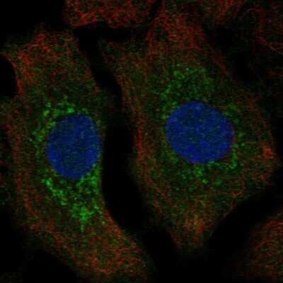 Immunocytochemistry/ Immunofluorescence: TPPP/p25 Antibody [NBP2-34031]