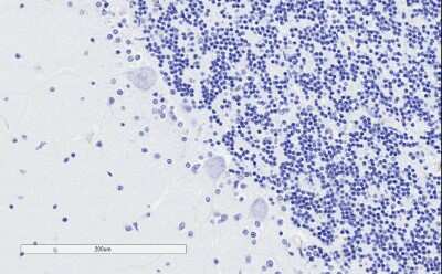 Immunohistochemistry-Paraffin: TPPP/p25 Antibody [NBP1-49833]