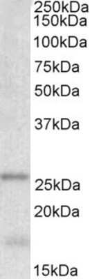 Western Blot: TPPP/p25 Antibody [NBP1-49833]